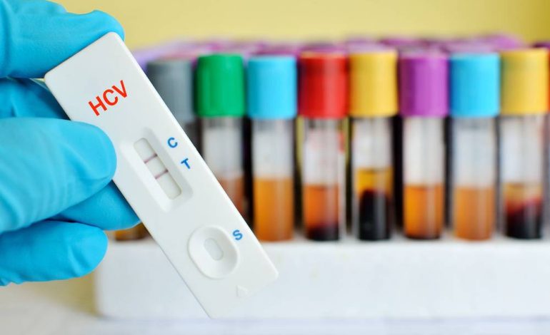 Testări gratuite pentru hepatita B și C pentru toți pacienții cu simptome, anunță Ministerul Sănătății